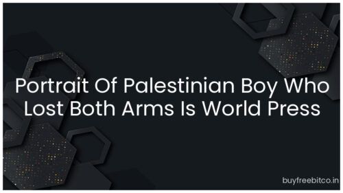 Portrait Of Palestinian Boy Who Lost Both Arms Is World Press Photo