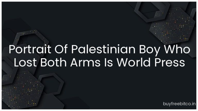 Portrait Of Palestinian Boy Who Lost Both Arms Is World Press Photo