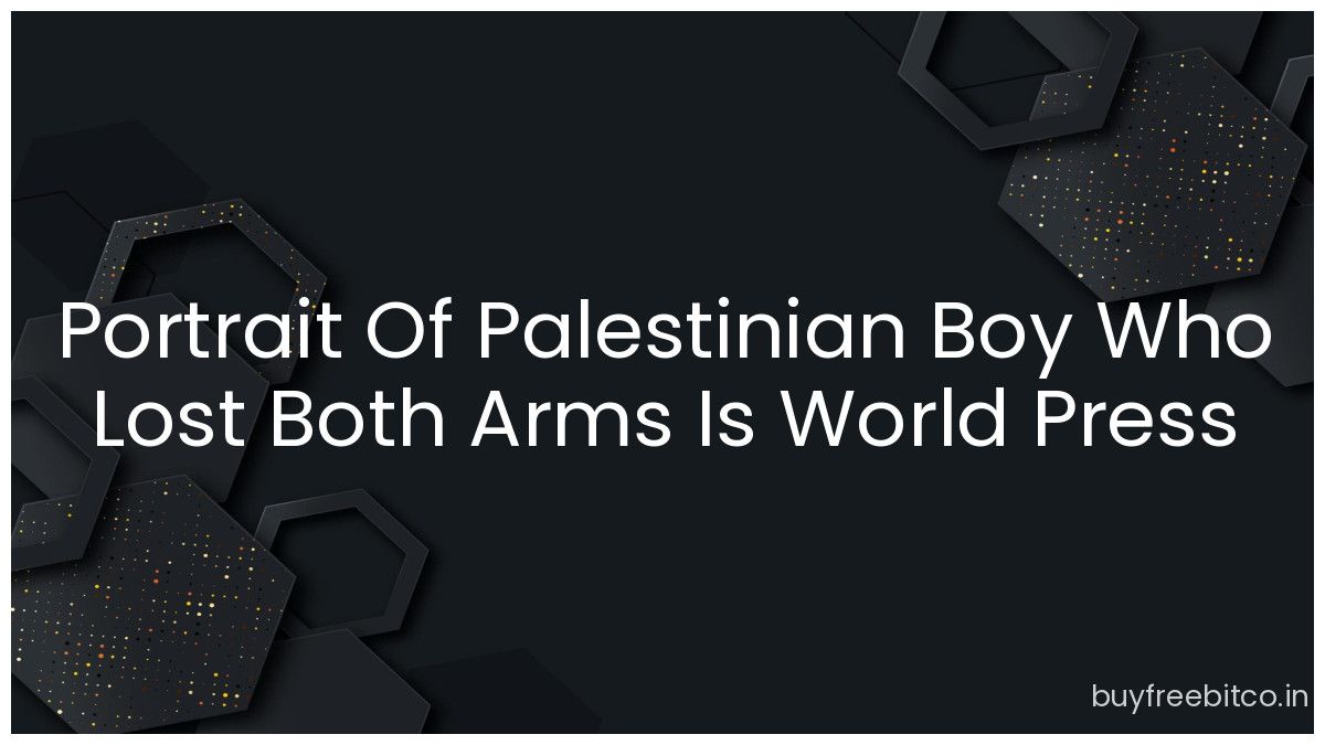 Portrait Of Palestinian Boy Who Lost Both Arms Is World Press Photo