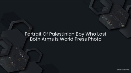 Portrait Of Palestinian Boy Who Lost Both Arms Is World Press Photo